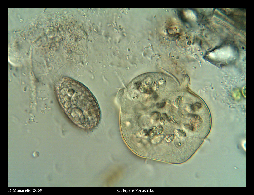 Coleps e Vorticella